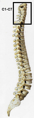 C1-C7 spinal injury