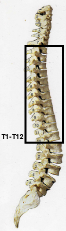 T1-T12 spinal cord injury